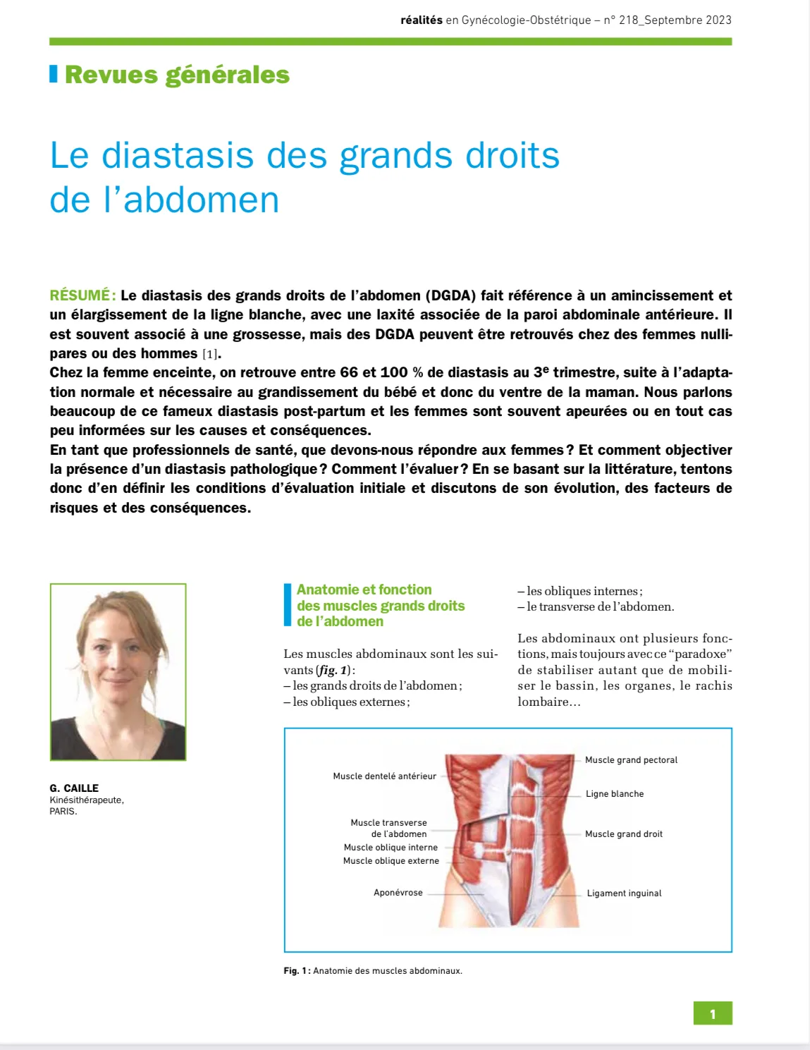 Article on abdominal muscle separation, health implications discussed.